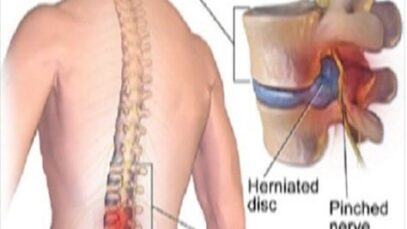 baba6f33771a31ec11050d2f9d0a7d76